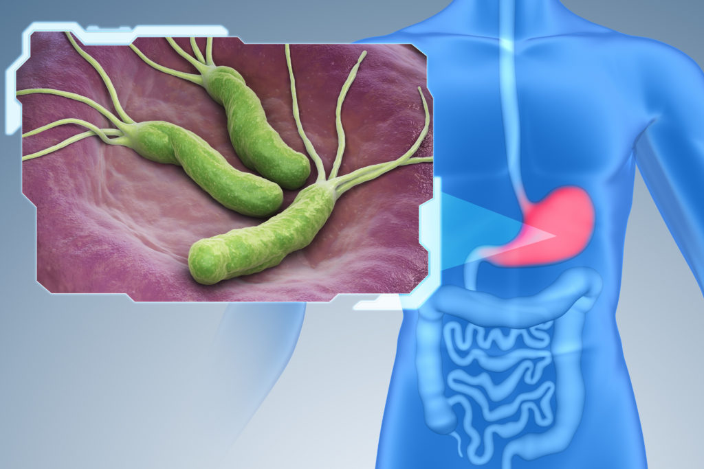 Wszystko co chciałbyś wiedzieć na temat Helicobacter pylori - Akademia ...